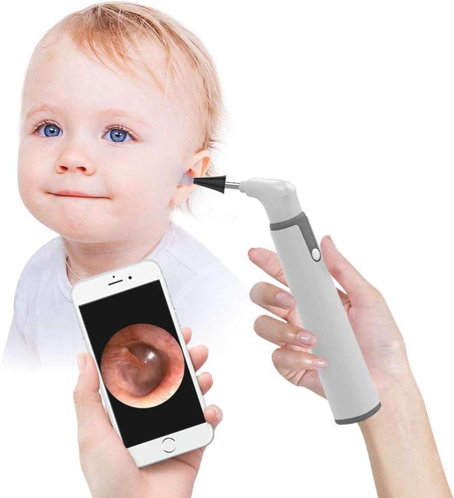 Wireless Otoscope, Ear Scope with 720P HD Ear Camera and 6 LED Lights, Ear Wax Removal Tool Camera with Gyroscope, Digital Otoscope with Light, Compatible with iPhone and Android