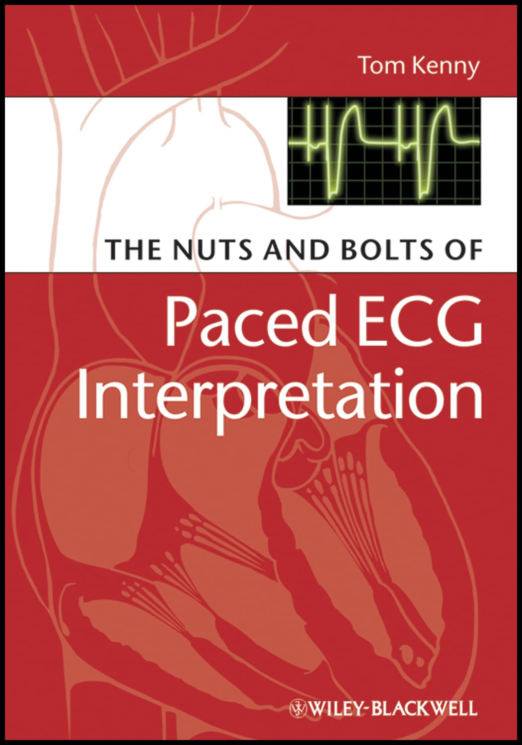 The Nuts and bolts of Paced ECG Interpretation (Nuts and Bolts Series (Replaced by 5113))