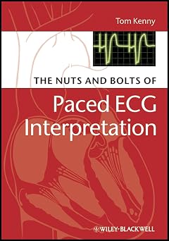 The Nuts and bolts of Paced ECG Interpretation Nuts and Bolts Series Replaced by 5113