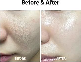 MEDITHERAPY Wrinkle fit Korean Mesh Sheet Masks (7EA), Collagen Mesh Sheet Mask for Glowing Skin, Daily Facial Mask, Hyaluronic acid Facial Mask, Korean Skincare