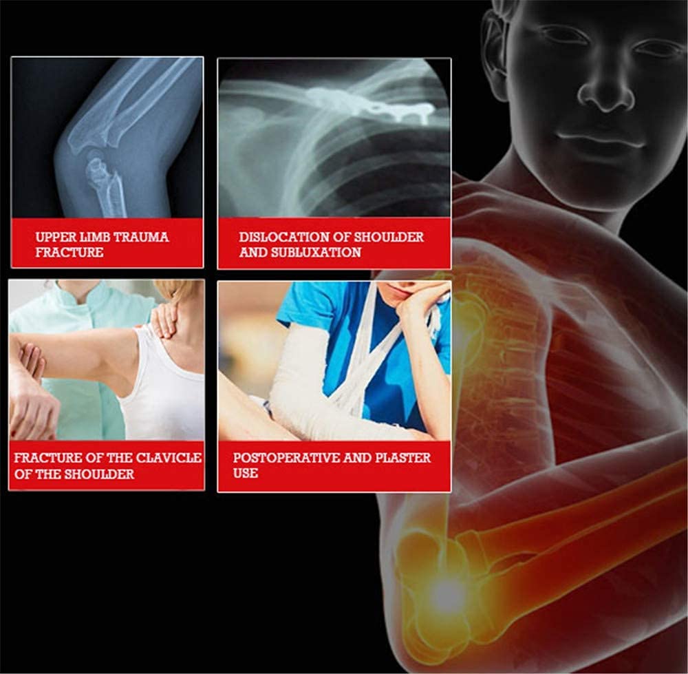 Inmovilizador de hombro con cabestrillo de brazo médico, soporte de manguito rotador, soporte de brazo transpirable para niños, inmovilizador de hombro con correa ajustable para recuperación