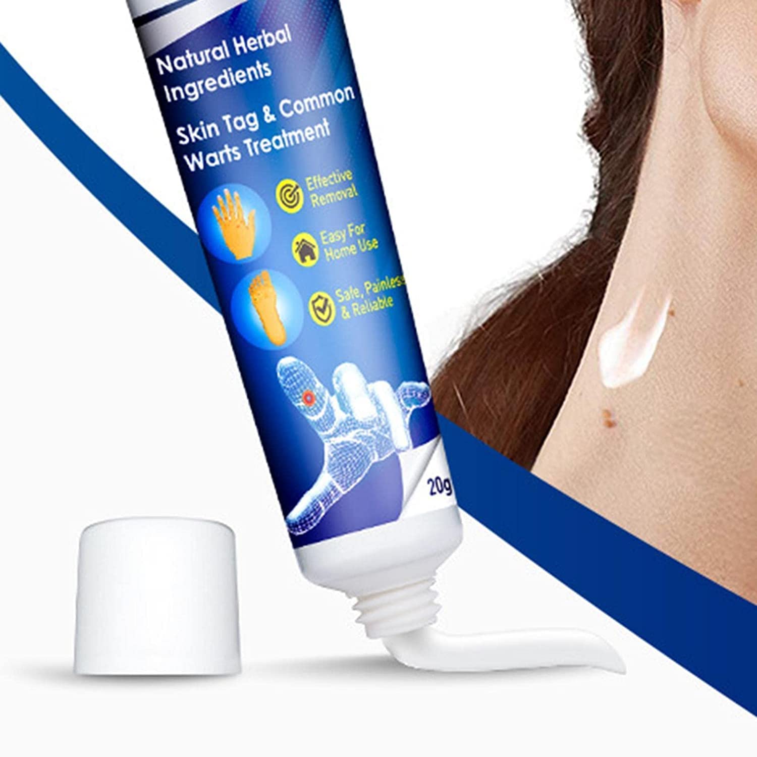 New Warts Remover Ointment Wart Treatment Cream Skin Tag Remover Herbal Extract - (Pack of 1) (B0CKT4XCVT) Amazon Price History, Amazon Price Tracker