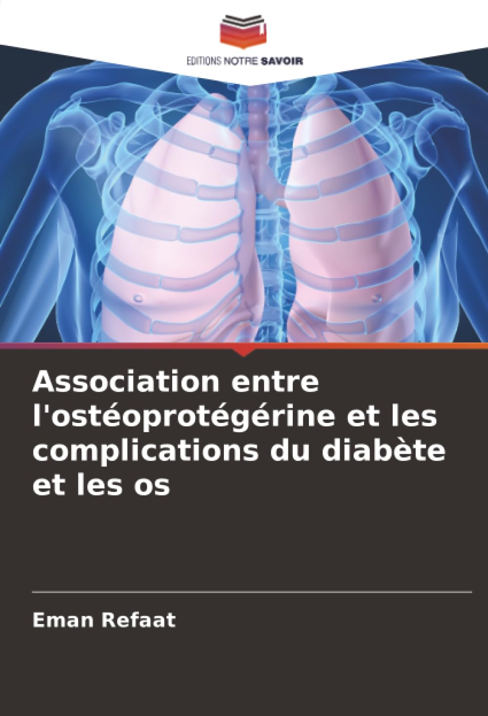 Association entre l'ostéoprotégérine et les complications du diabète et les os