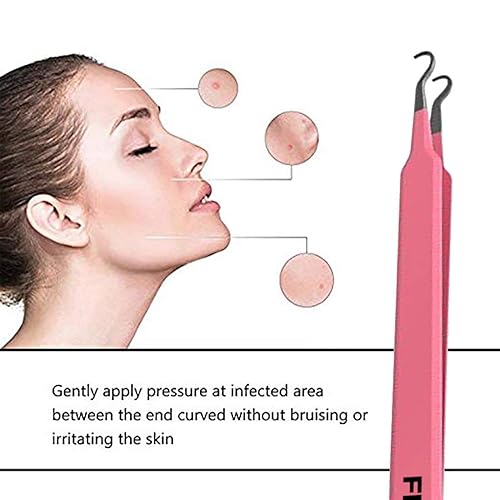 Miniatura 2 de Pinzas de extracción de acné de puntos negros, herramienta de extracción de comedones curvada de acero inoxidable de grado quirúrgico y profesional