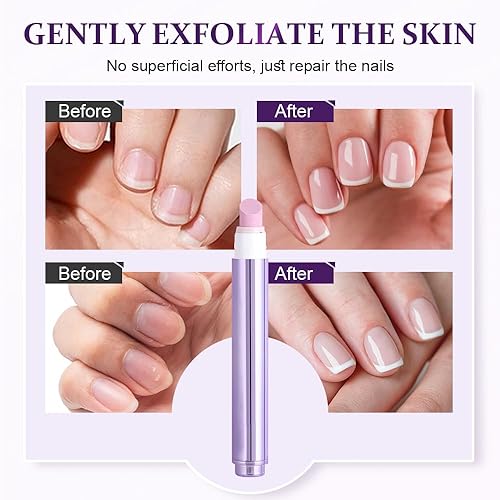 Miniatura 4 de Bolígrafo de aceite 3 en 1 para cutículas, bolígrafo de aceite de cutícula de cerámica mejorado 2026 para uñas, bolígrafo de cuidado de uñas,