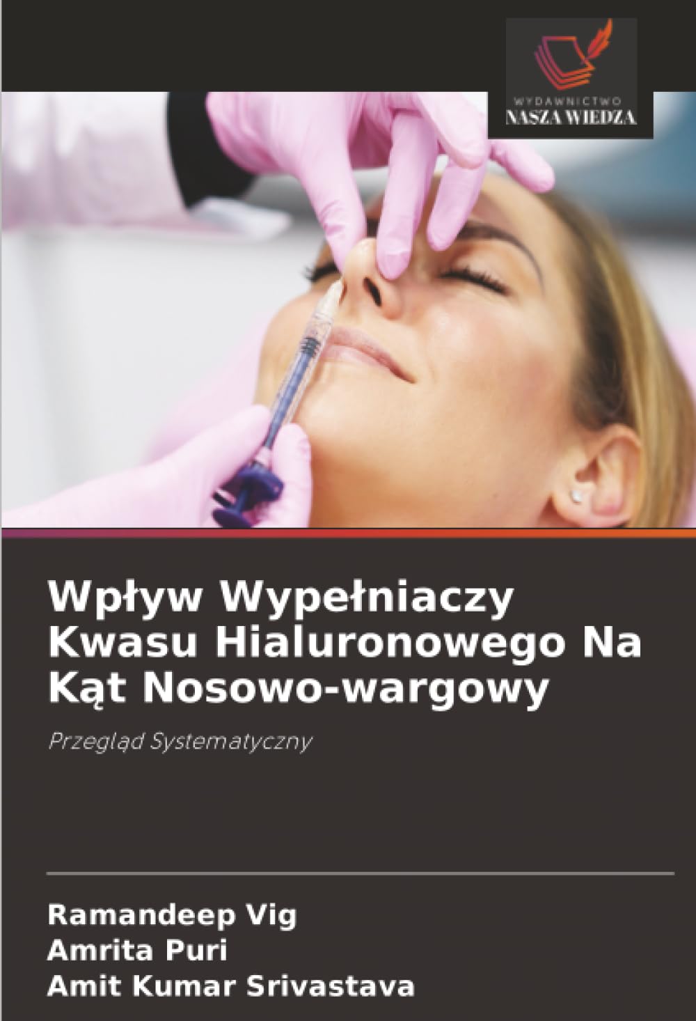 Wp¿yw Wype¿niaczy Kwasu Hialuronowego Na K¿t Nosowo-wargowy: Przegl¿d Systematyczny