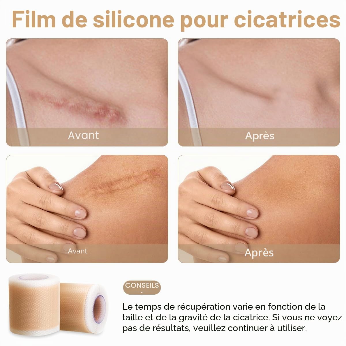 Pansements silicone cicatrice 2 pièces – Pansement cicatrisant pour cicatrices anciennes et récentes – Silicone scar sheets anti-UV, cache cicatrice soleil
