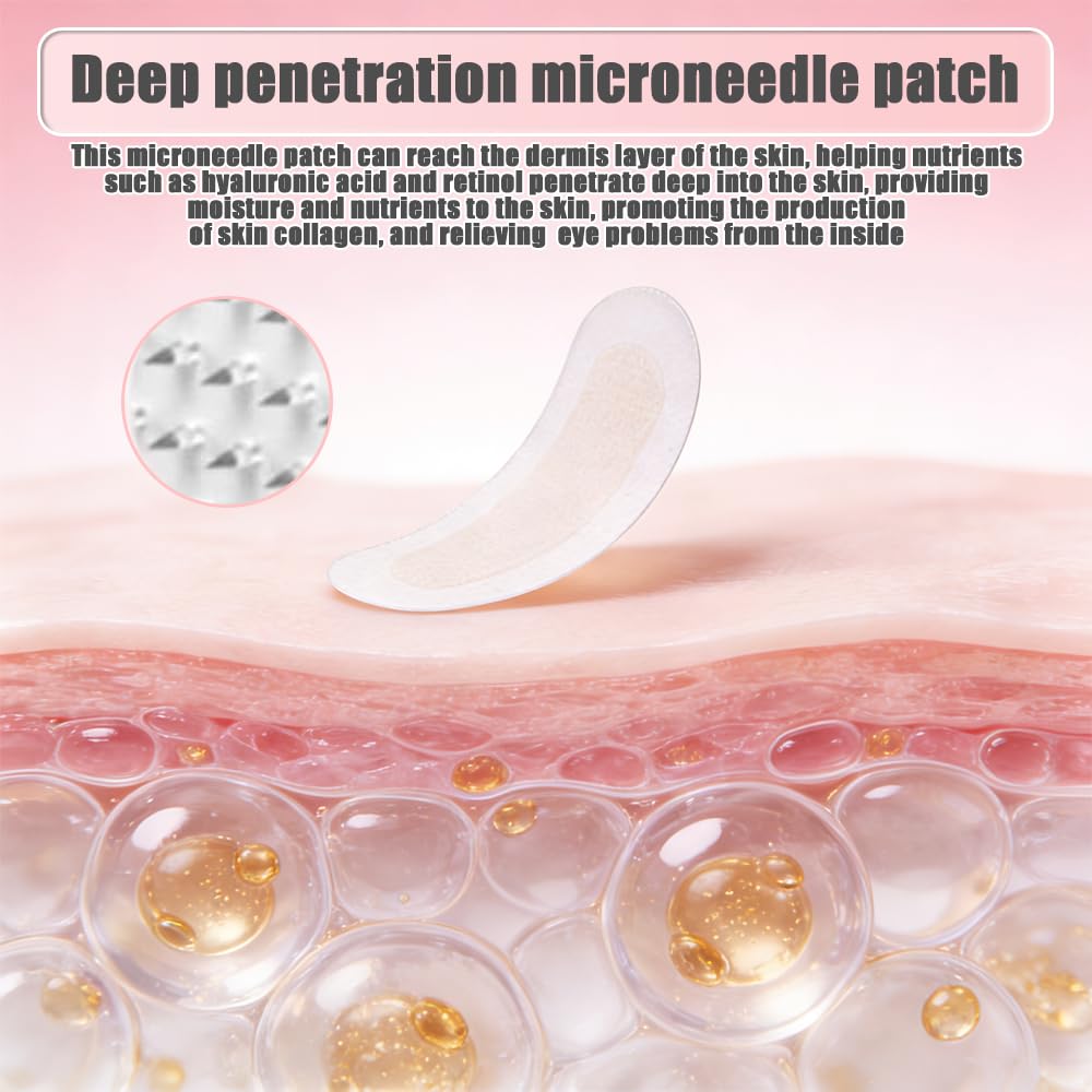 Microneedling Patches 4 pary, mikroneedling Eye Patches przeciw workom pod oczami i zmarszczkom, hialuronowe mikro-igłowanie, płatki pod oczy redukują cienie pod oczami, zmarszczki na czole i