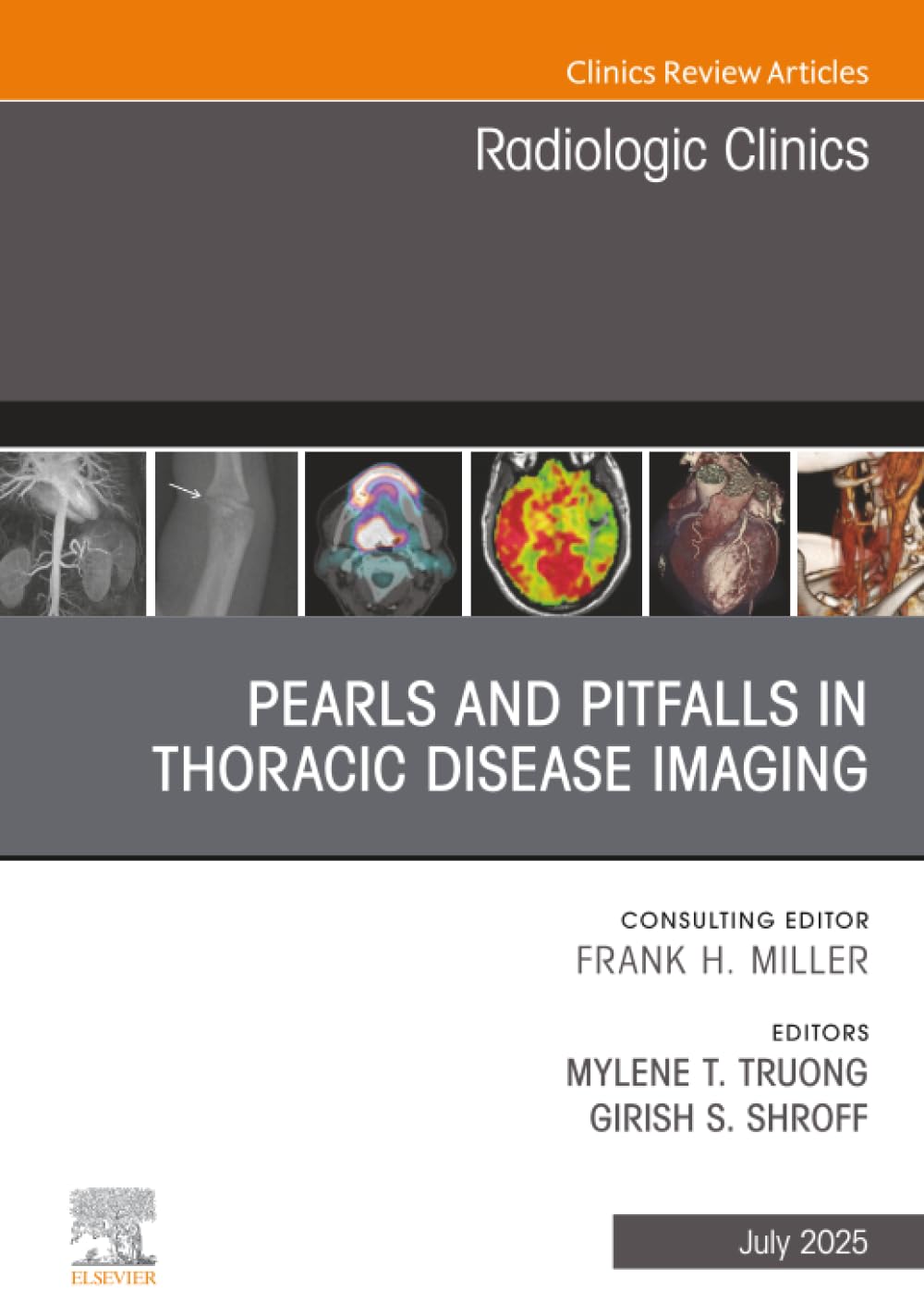 Pearls and Pitfalls in Thoracic Disease Imaging, An Issue of Radiologic Clinics of North America: Volume 63-4 (The Clinics: Radiology, Volume 63-4)