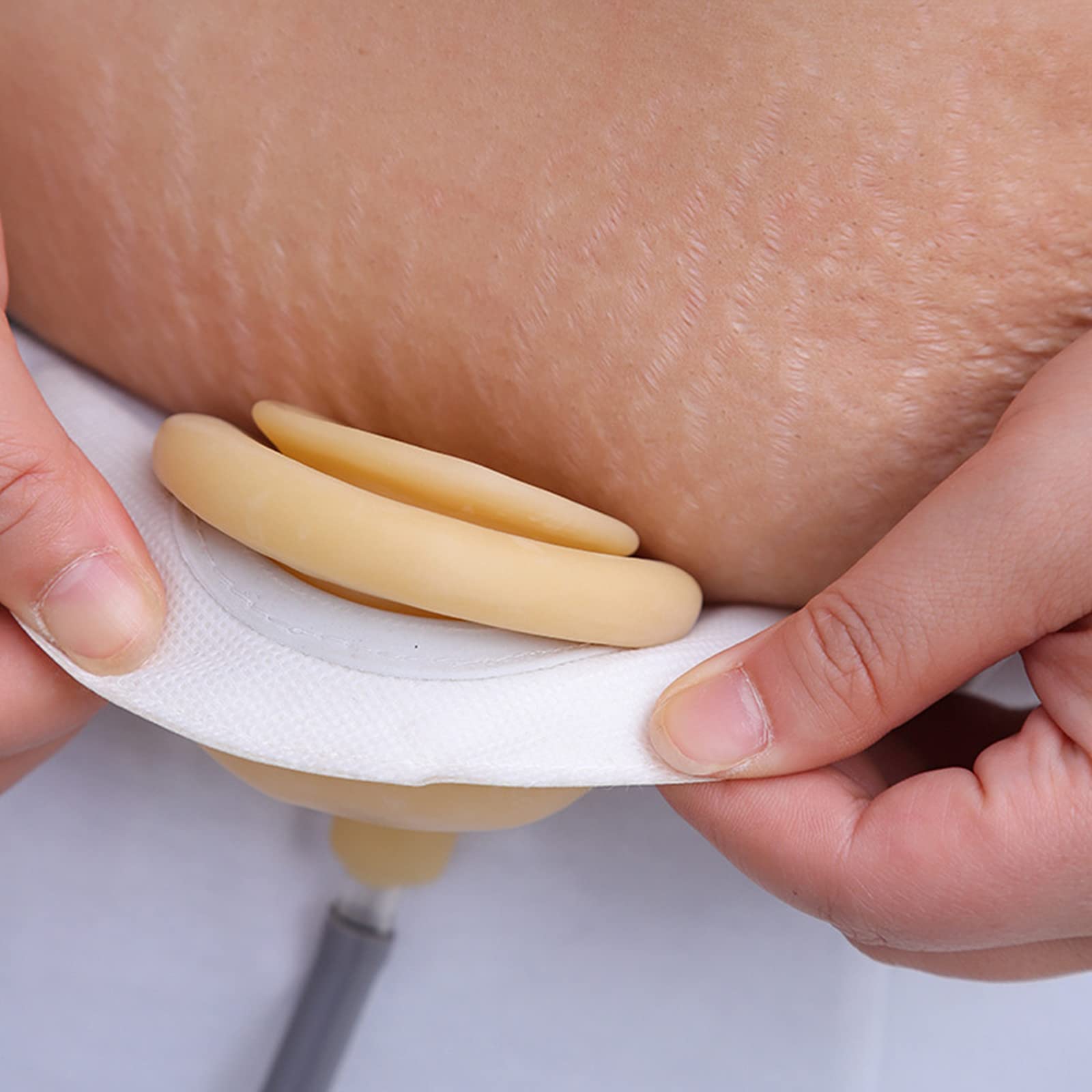 Cinturón de soporte for bolsa ostomía fija y previene la hernia paraestomal en pacientes con colostomía. Incluye 2 correas for las piernas
