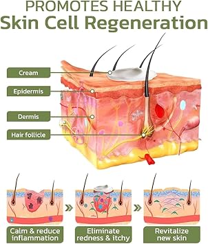 Keratosis Treat Deep Clean Smooth Cream,Deep Clean Smooth Cream,for Rough and Bumpy Dry Skin,Keratosis Pilaris Treatment Cream