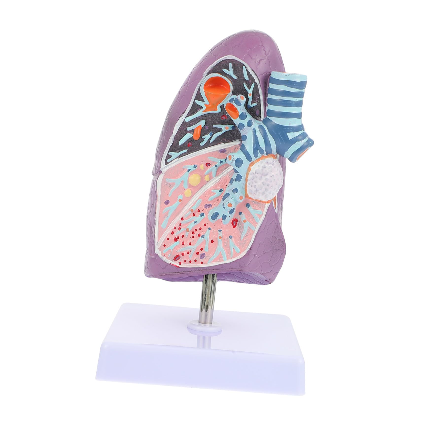 Poumon Pathologique de Fumeur Modèle Anatomique de Formation Médicale - 8
