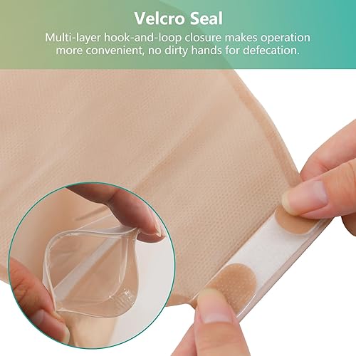 Miniatura 5 de 20 bolsas de colostomía, suministros de ostomía, bolsas de ostomía de una pieza con cierre, bolsas drenables para el cuidado del estoma de ileostomía