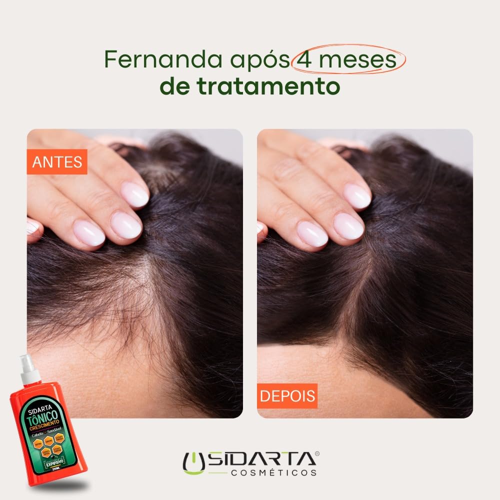 Super Tônico capilar crescimento, anti-queda e fortalecimento. em promoção! Veja a oferta e mais achadinhos de Óleos, Séruns e Tônicos 5 Hoje é o melhor dia para comprar Super Tônico capilar crescimento, anti-queda e fortalecimento. com aquele preço maroto! Promoção! Aproveite a oferta! 5