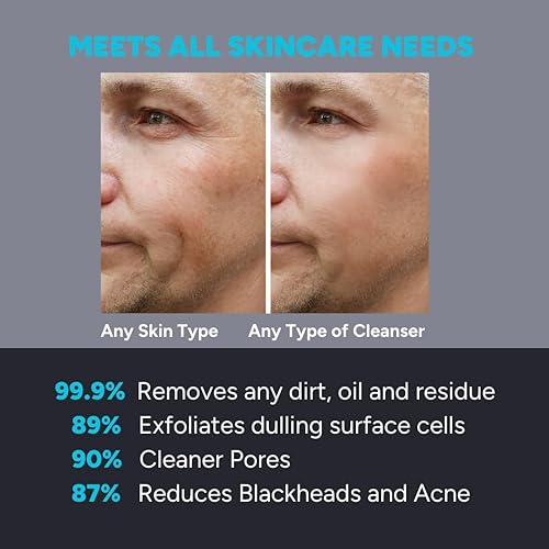 Miniatura 7 de Peony - Cepillo de limpieza facial de silicona, masajeador facial antienvejecimiento con 12 engranajes, herramienta de lavado facial exfoliante para