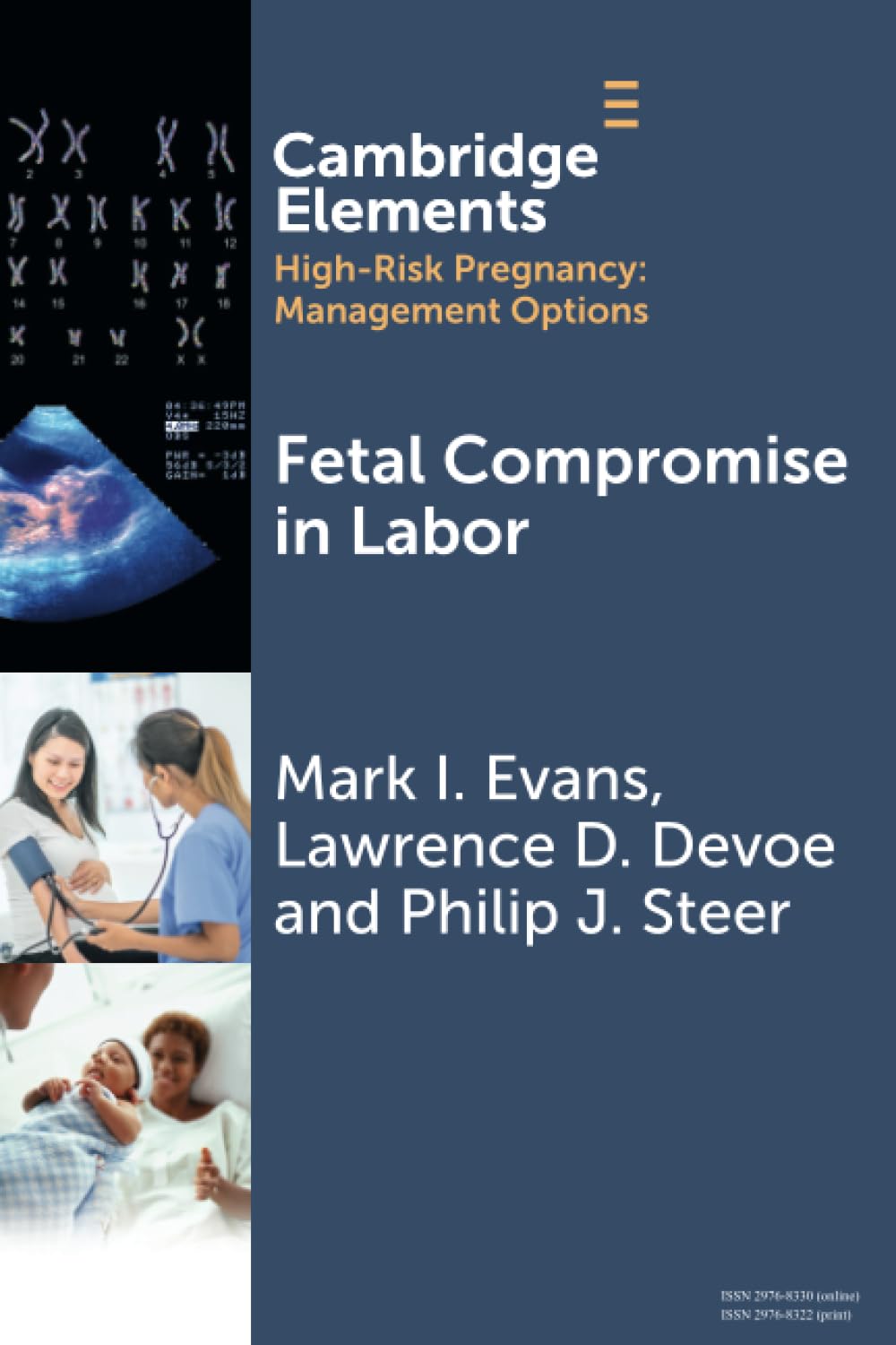 Fetal Compromise in Labor (Elements in High Risk Pregnancy: Management Options)