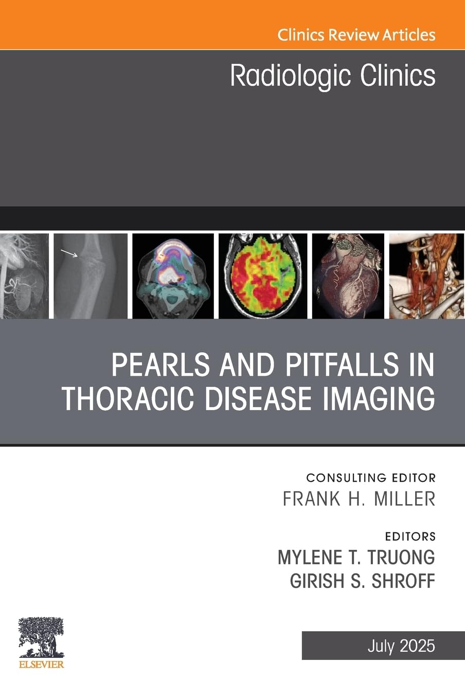 Pearls and Pitfalls in Thoracic Disease Imaging, An Issue of Radiologic Clinics of North America: Volume 63-4 (The Clinics: Radiology, Volume 63-4)
