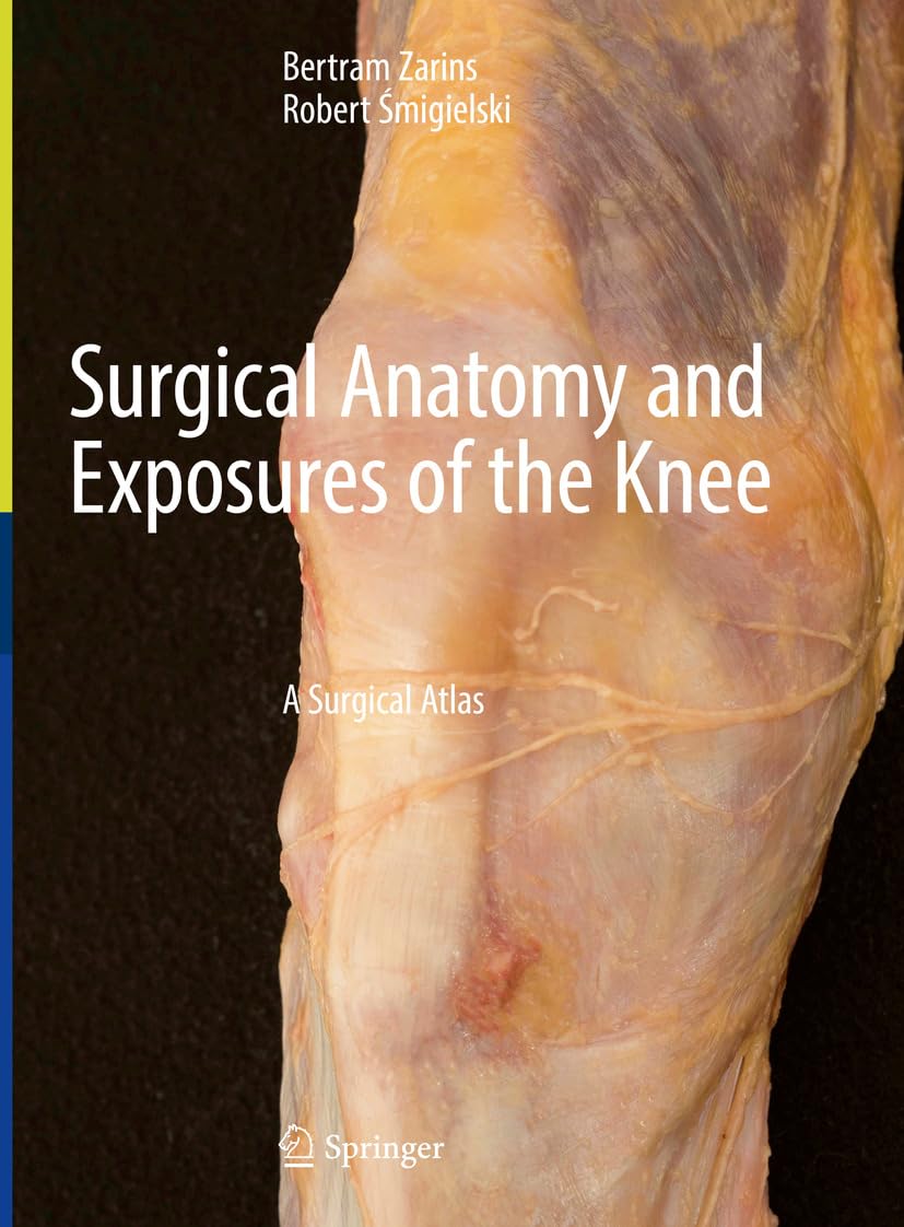 Surgical Anatomy and Exposures of the Knee: A Surgical Atlas (English Edition)