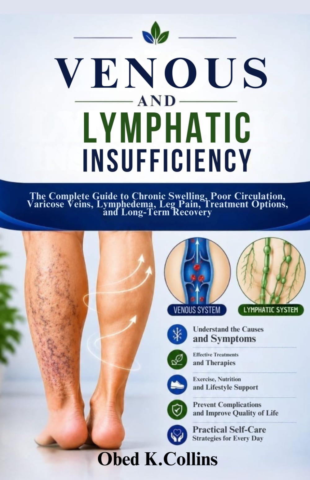 Venous And Lymphatic Insufficiency: The Complete Guide to Chronic Swelling, Poor Circulation, Varicose Veins, Lymphedema, Leg Pain, Treatment Options, and Long-Term Recovery