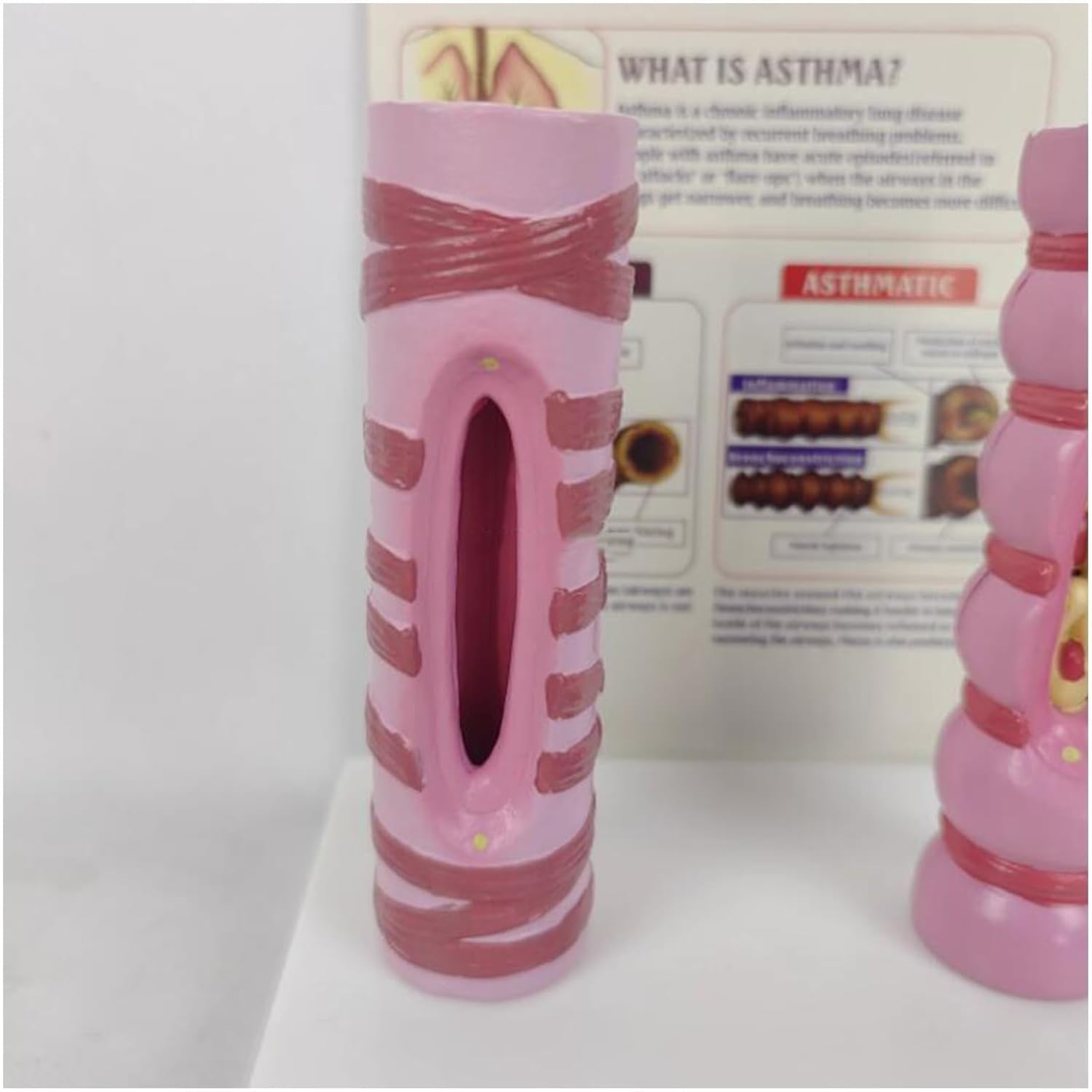VERIMP Human Trachea Contrast Model Organ Anatomy Respiratory System Structure Human Healthy Trachea and Pathological Comparison Model - Pathology Lung Tube Trachea Comparison Model
