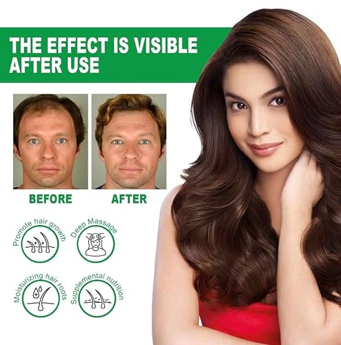 Miniatura 8 de Dash Aceite de crecimiento del cabello, aceite de romero avanzado para el crecimiento del cabello, mezcla única de aceite capilar para cabello seco