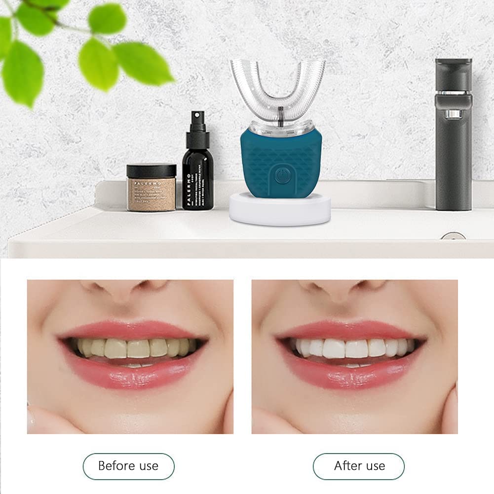 Cepillo de Dientes Ultrasónico Automático, 360 ​​° Cepillo de Dientes Eléctrico y Kit de Blanqueamiento Dental, para Cargar IPX7 a Prueba de Agua con 2 Cabezales de Repuesto (Ejercito Verde)