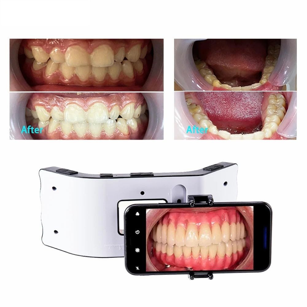 Flash Dentale, Lampada di riempimento Orale, Attrezzatura Fotografica, Luce Ambientale, Lampada Fotografica, Strumenti per odontoiatria