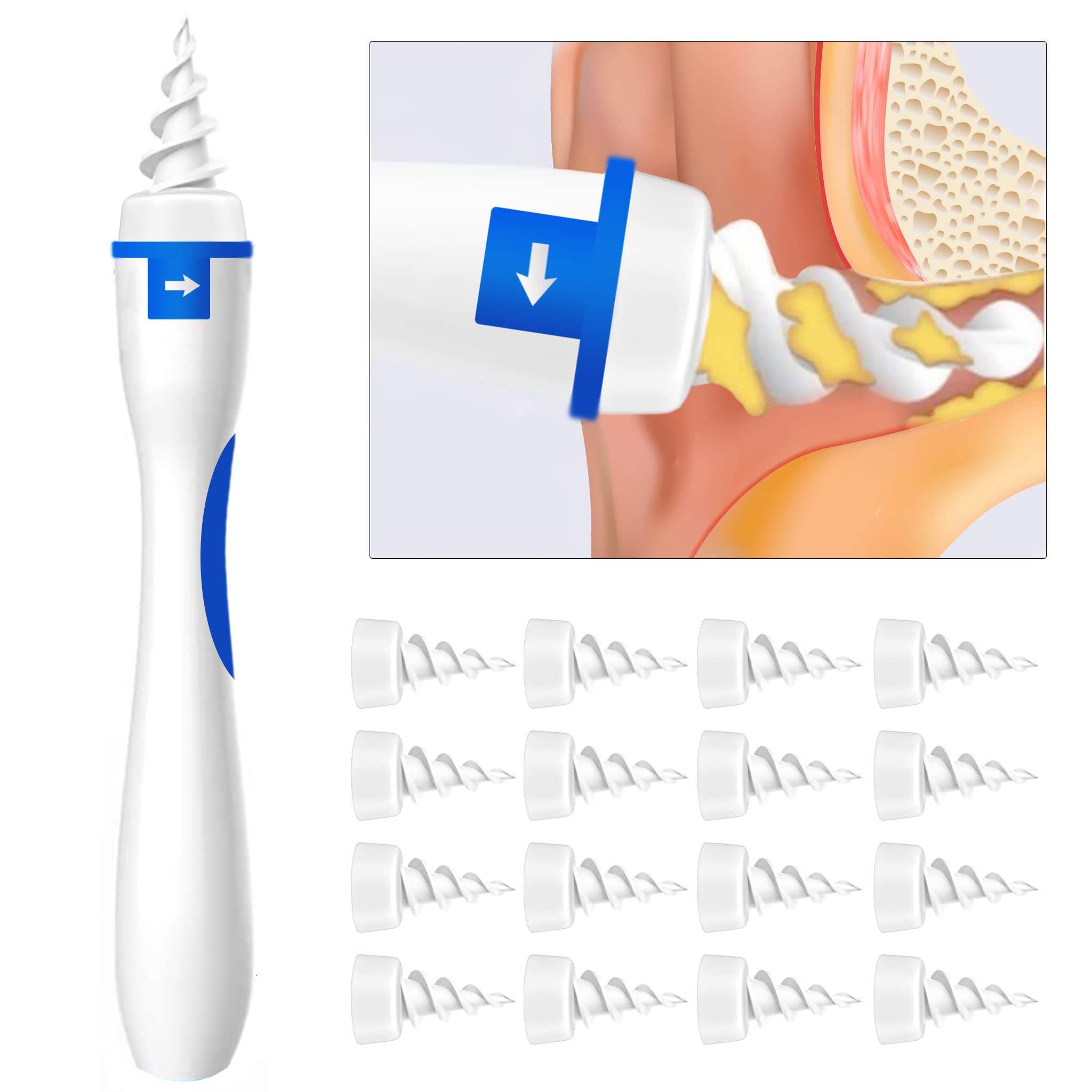 Buy Ear Wax Removal Kit with Camera, 1080P Ear Endo Earwax Removal Kit