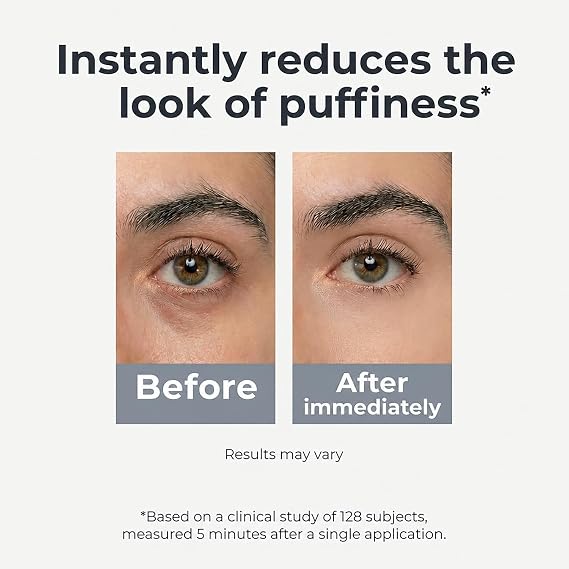 Under Eye Brightener Roller - Caffeine & Retinol Eye Serum for Dark Circles, Puffiness & Fine Lines, Travel Essential Vegan Skincare, Cooling Eye Massage, Dermatologist-Tested, 0.52 fl oz