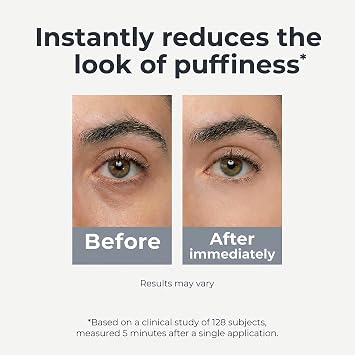 Under Eye Brightener Roller - Caffeine & Retinol Eye Serum for Dark Circles, Puffiness & Fine Lines, Travel Essential Vegan Skincare, Cooling Eye Massage, Dermatologist-Tested, 0.52 fl oz