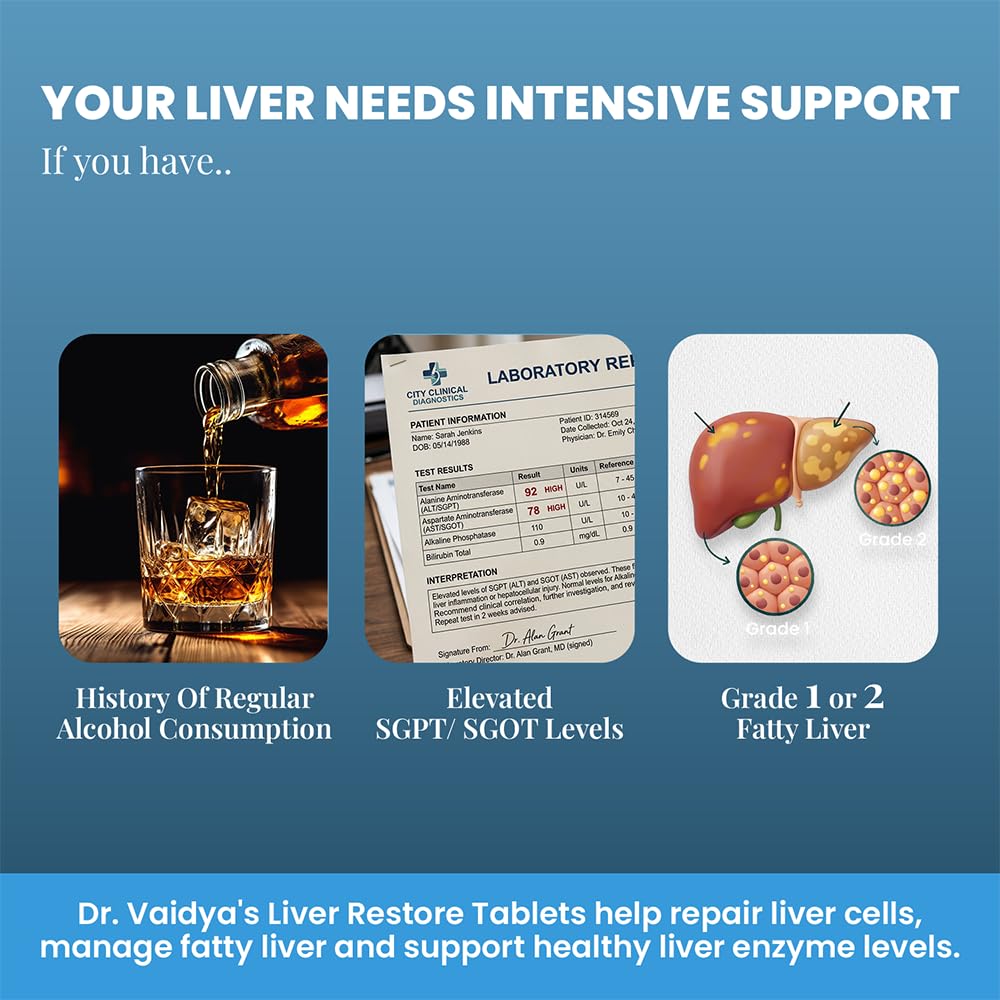 Dr. Vaidya’s Liver Restore Tablets with Milk Thistle and Dandelion | 600mg Silymarin | Ayurvedic Liver Detox & Care Supplement | Supports Liver Health, Cleansing, Digestion & Metabolism | 30 Tablets, Pack of 1 1
