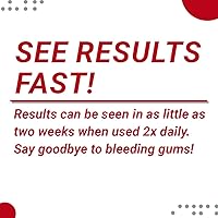 Vista 6 de Perio Care Gel para bandejas (3 tubos + bandejas) – 1.7% gel de peróxido de hidrógeno – Comparar con Perio Gel, Perio Gel X, Perio Protect Gel, GumX