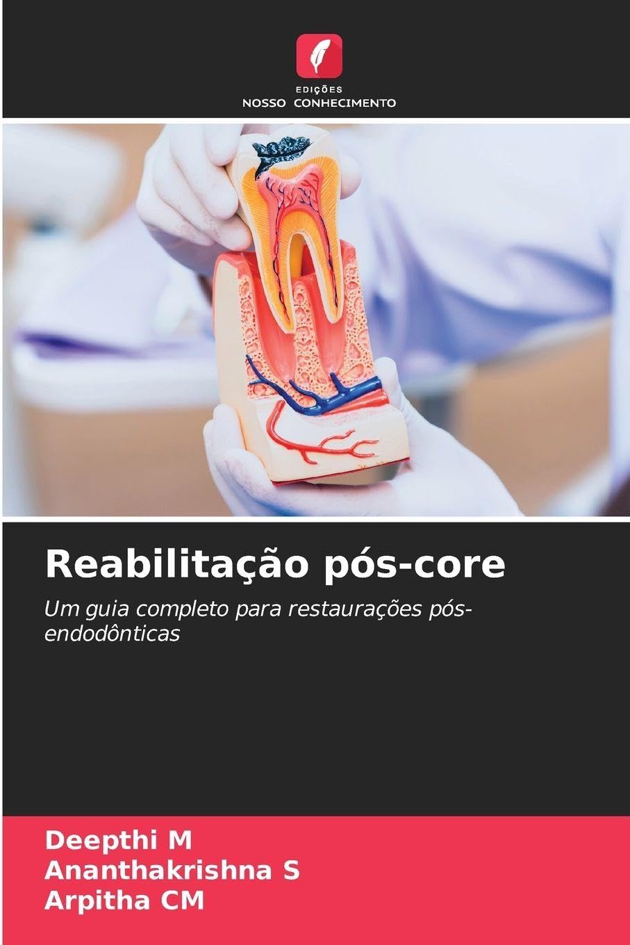 Reabilitação pós-core: Um guia completo para restaurações pós-endodônticas