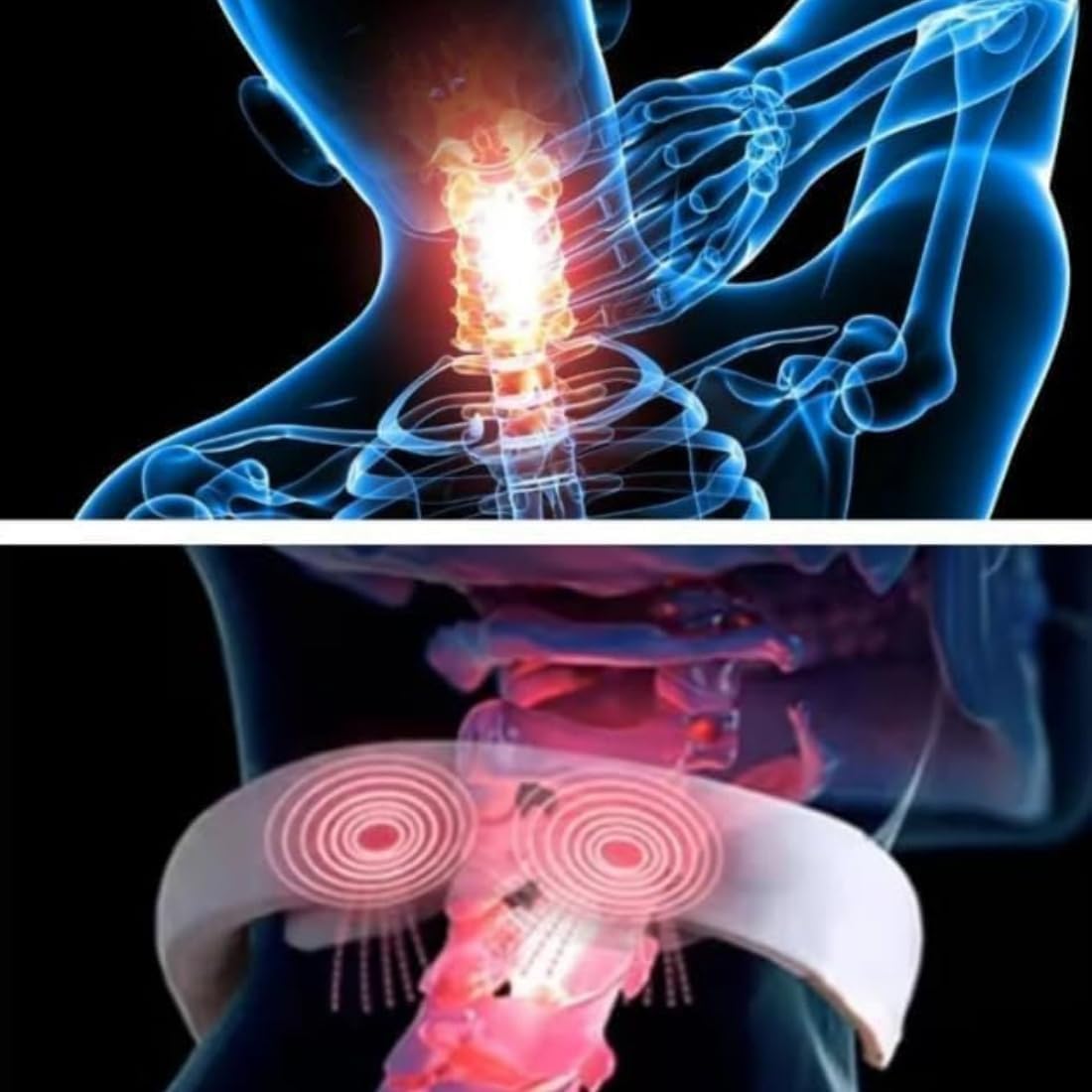 Aurenova Sereni Stim Zervikales Neuromodulationsgerät, Nackenmassagegerät für Nackenschmerzen, Sereni Stim Nacken, schnurloses Design und einstellbare Modi, löst tiefe Muskelverspannungen hinter