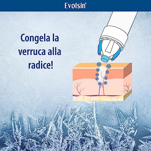 Evolsin® Spray Congelante Per Verruche Comuni E Verruche Plantarii Congelamento Delle Verruche Igienico E Sicuro I Effetto Clinicamente Confermato I Rimedio Per Le Verruche + 12 Applicatori - 6