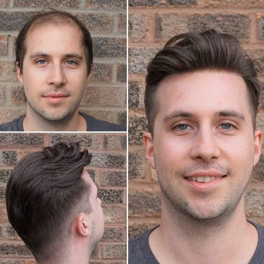 Toupee for Men European Real Human Hair Replacement Systems Men Hairpieces Fino Mono Lace Center Thicker Skin PU Hair Piece for Man Wigs 8x10 Inches #4 Medium Brown Color