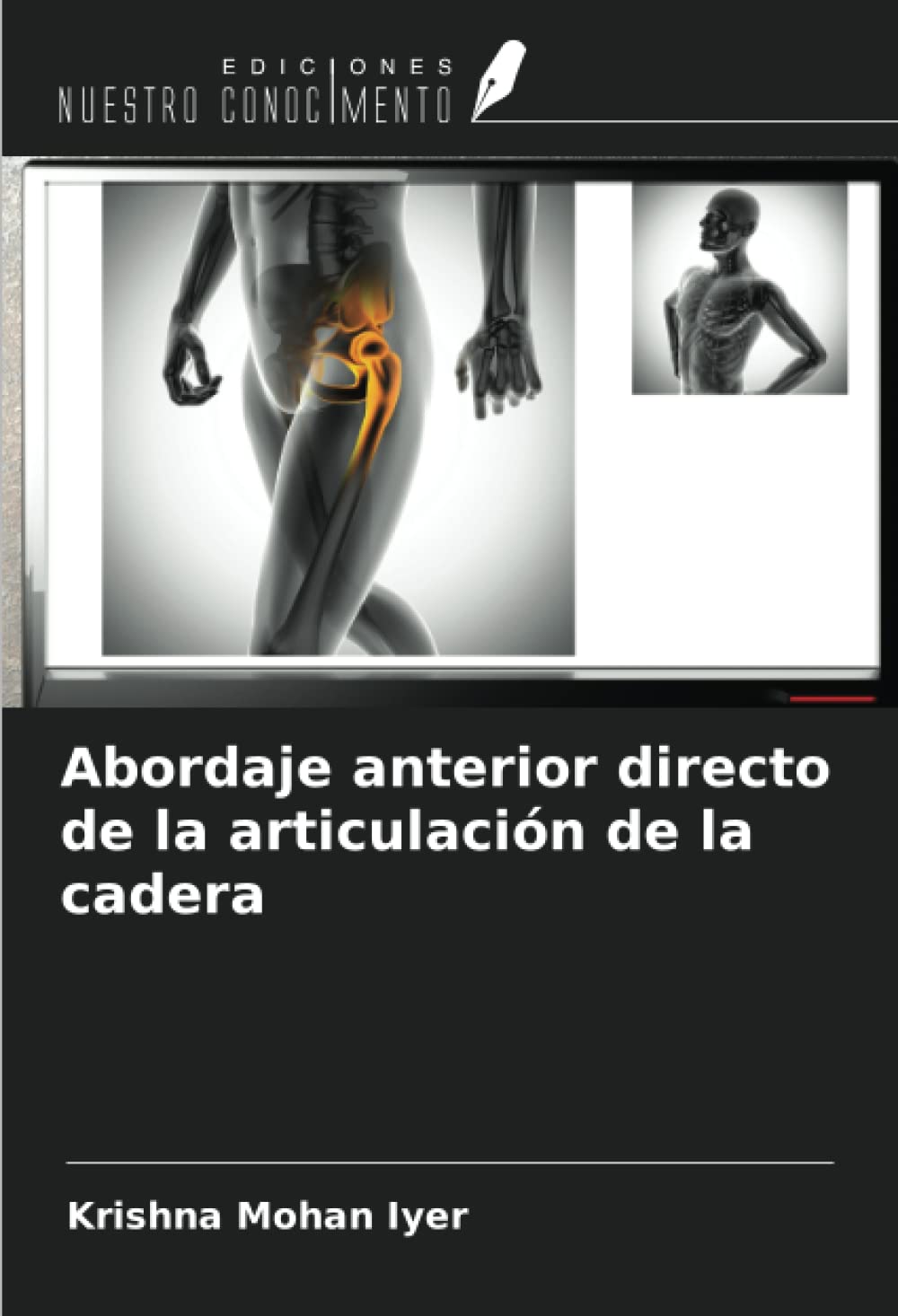 Abordaje anterior directo de la articulación de la cadera (Spanish Edition)