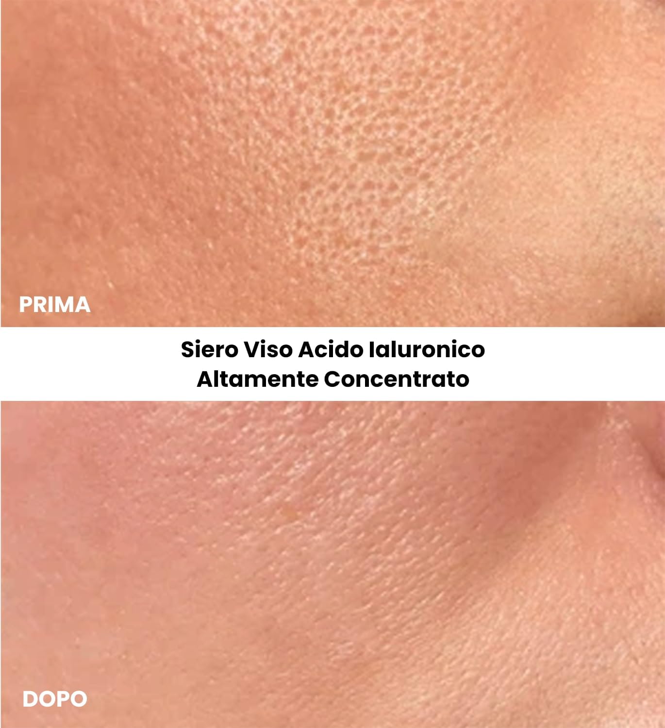 Kleem Siero Acido Ialuronico Viso Idratante e Rimpolpante con Acido Ialuronico all’1.8% – Siero Viso Antirughe ad Alta Efficacia per una Pelle più Elastica - Bio & Vegano - Idratazione 24H