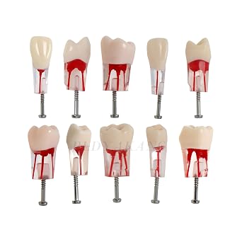 Dental RCT Root Canal Practice, Teaching, Study Teeth Model, fits Typodont Model NISSIN 200 Type 28 Teeth M8006-10 RCT Root Canal Practice Model