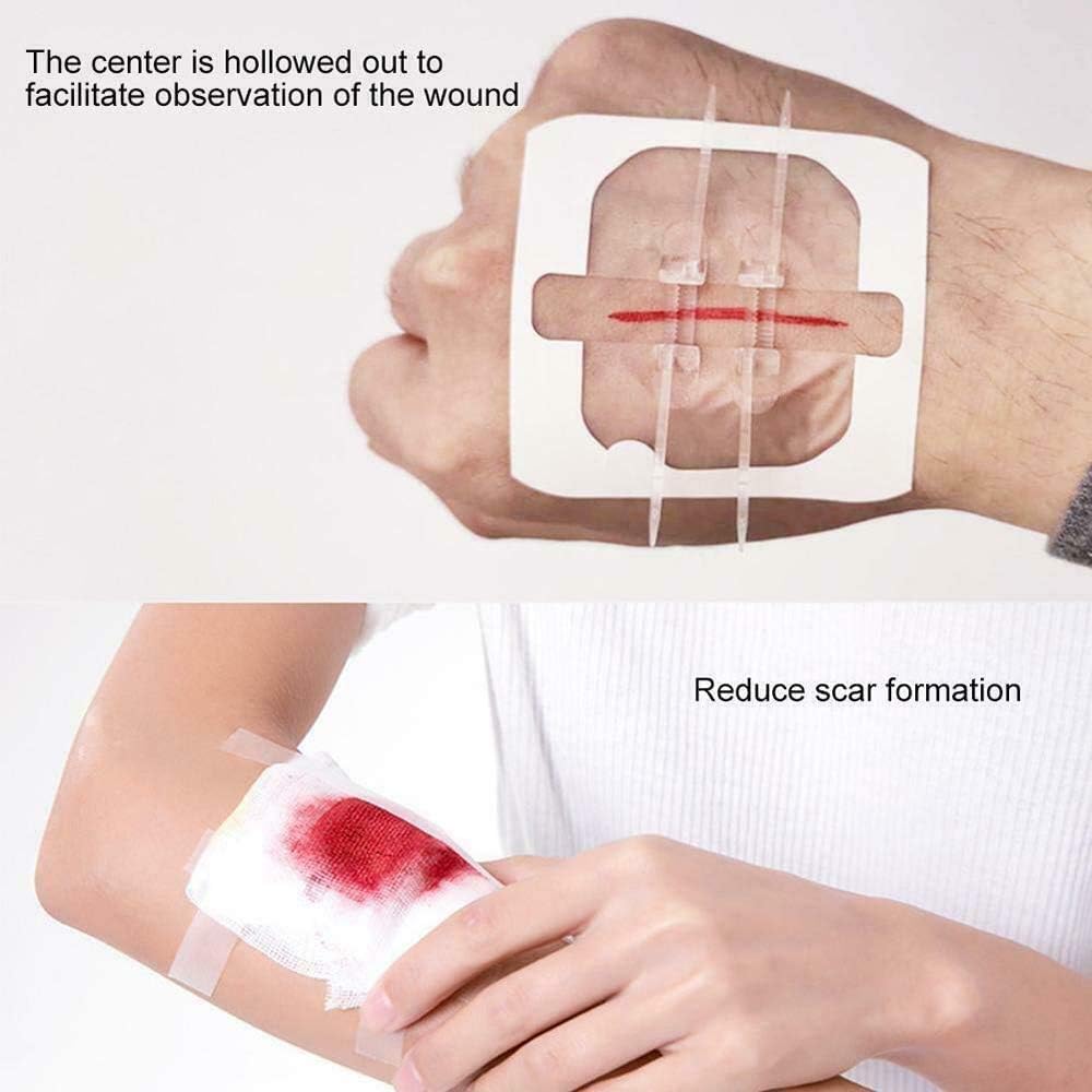 Buy Zipper Painless Zip Stitch Sutures Waterproof Wound Closure Strips Device Suture Free Patch Zipper Emergency Laceration Closures Close Wounds Without Stitches Reduce Scar Area 2 Pcs Online In Indonesia B08sj3ncll