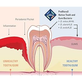 ProBiora Oral-Care Chewable Probiotic Tablets | Probiotic Supplement for Women & Men | Healthier Teeth & Gums | Fresher Breath | Whiter Teeth | Better Overall Health | 30 Count | Pack of 3 | Mint