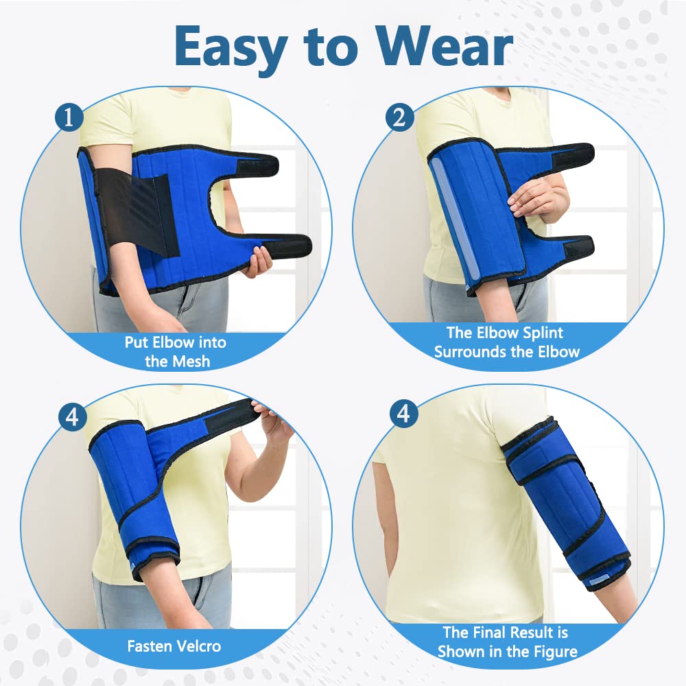 Elbow Splint Ulnar Nerve Elbow Brace Night for Cubital Tunnel Syndrome Elbow Immobilizer Stabilizer Brace Sleeping for Arthritis Pain Relief Tendonitis Arm Support Splint for Women Men (L)