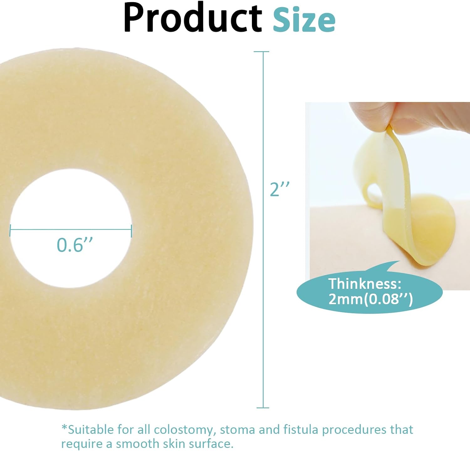 20PCS Ostomy Barrier Rings, Medical Hydrocolloid Ostomy Supplies, Moldable Ostomy Ring, Leak-Free Skin Extender Rings, Stoma Protector Seal for Colostomy Bags