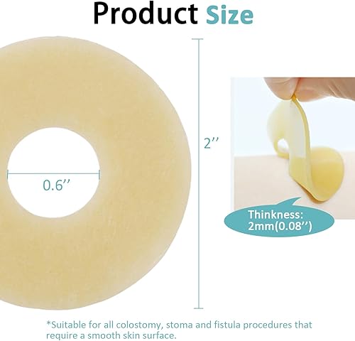 Miniatura 4 de 20 anillos de barrera para ostomía, suministros de ostomía hidrocoloide médica, anillo de ostomía moldeable, anillos extensores de piel sin fugas,