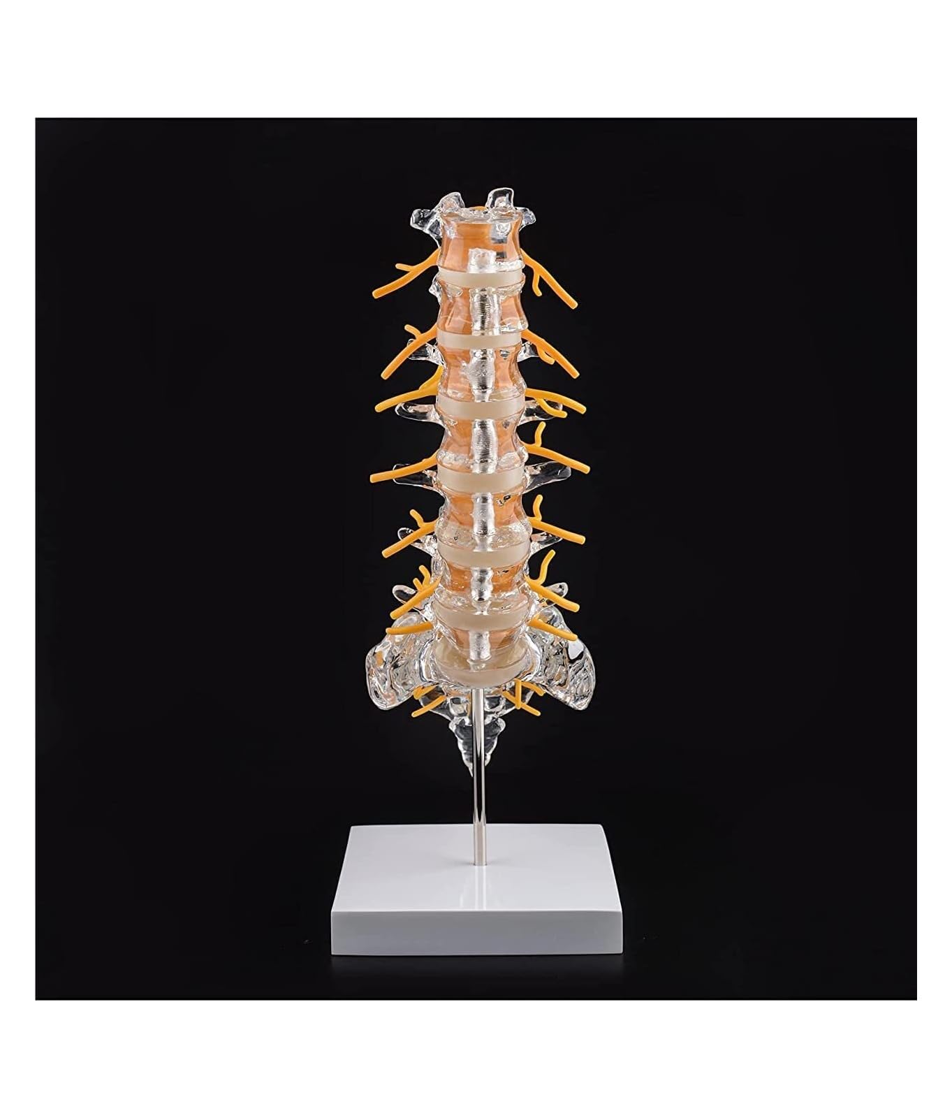 Nervi spinali ed ernia del disco da esporre, modello di colonna vertebrale umana trasparente Modello di colonna vertebrale lombare umana con sacro