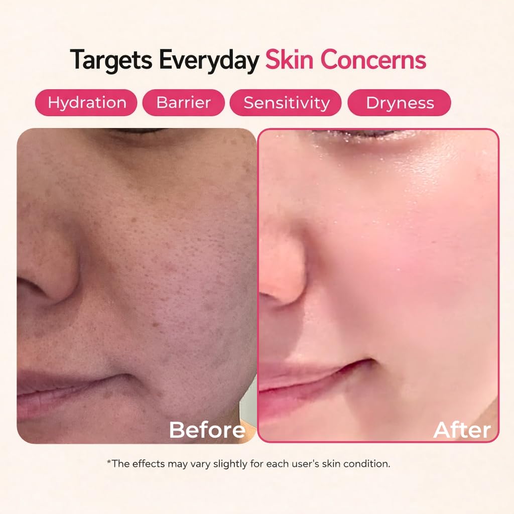 Ceramide, Ectoin & Hyaluronic Acid Lotion for Dry & Sensitive Skin, Barrier Repair Moisturizer, Fragrance-Free, Dermatologically Tested, Korean Skincare, 100 ml