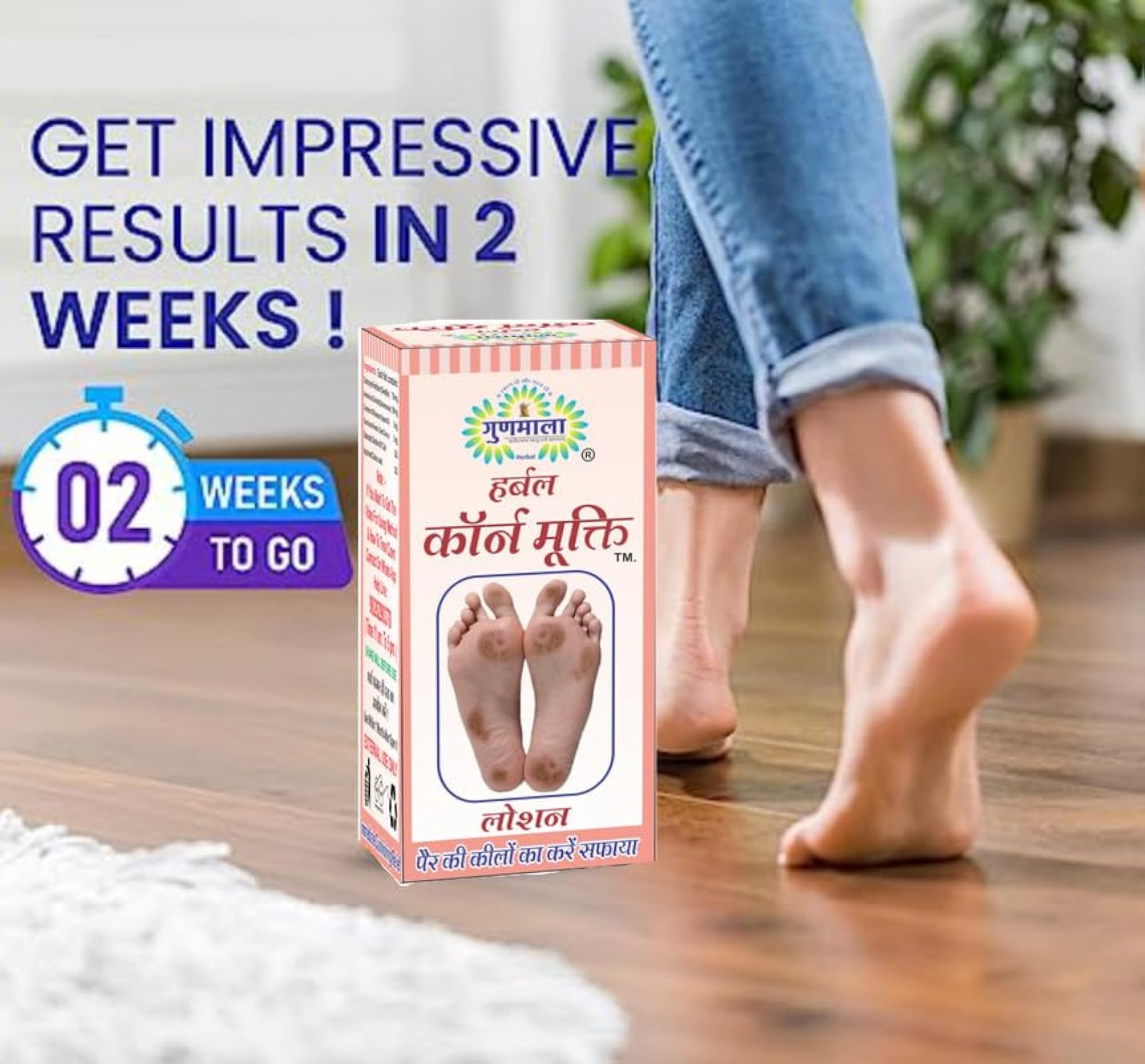 Corn Mukti Lotion for Foot Callus, Pack of 5