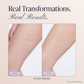 Westmore Beauty Body Coverage Perfector Waterproof Leg & Body Makeup/Bronzer For Women - Best Tattoo Cover Up Makeup & Tattoo Concealer - 7 Oz Light Radiance