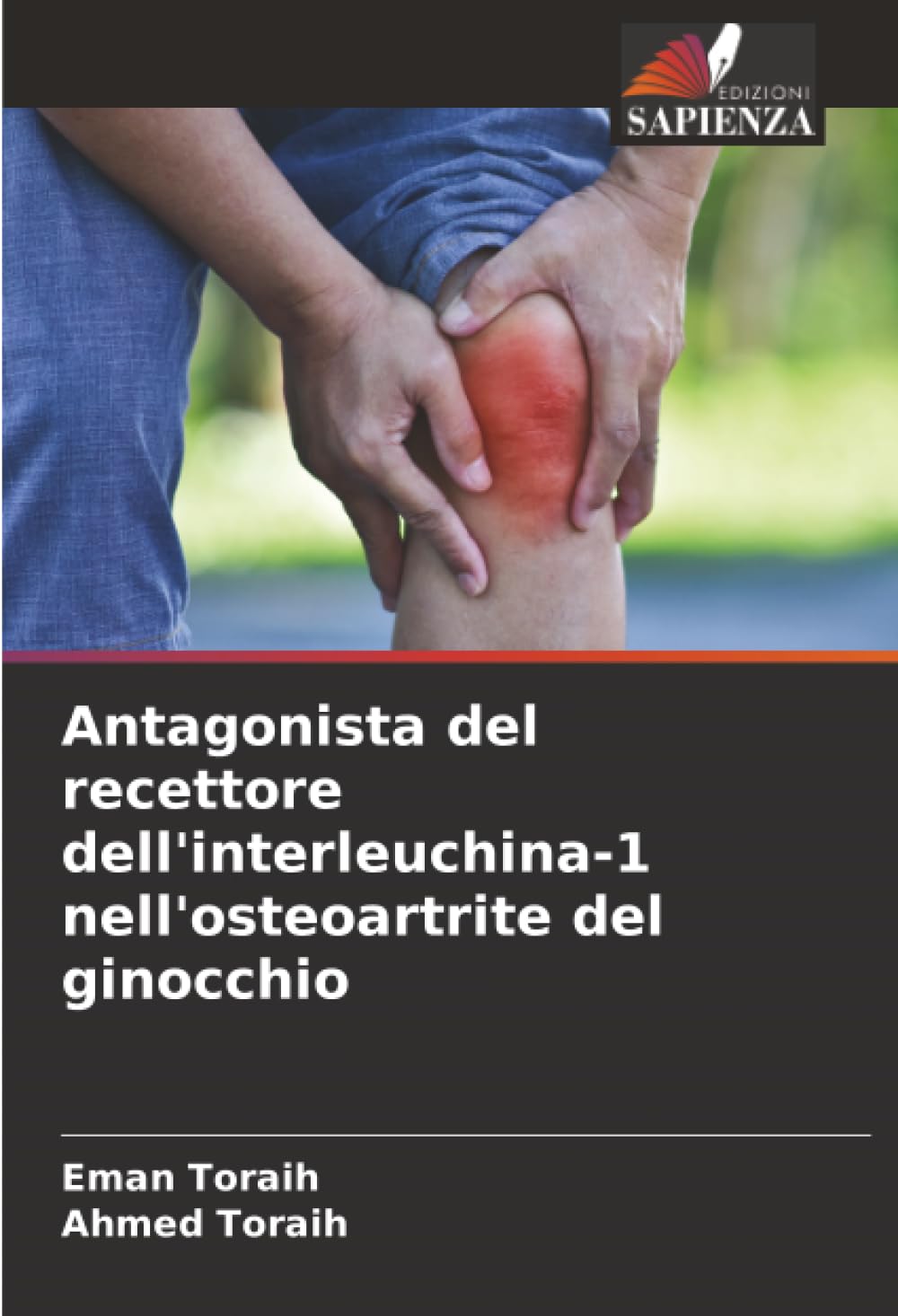 Antagonista del recettore dell'interleuchina-1 nell'osteoartrite del ginocchio