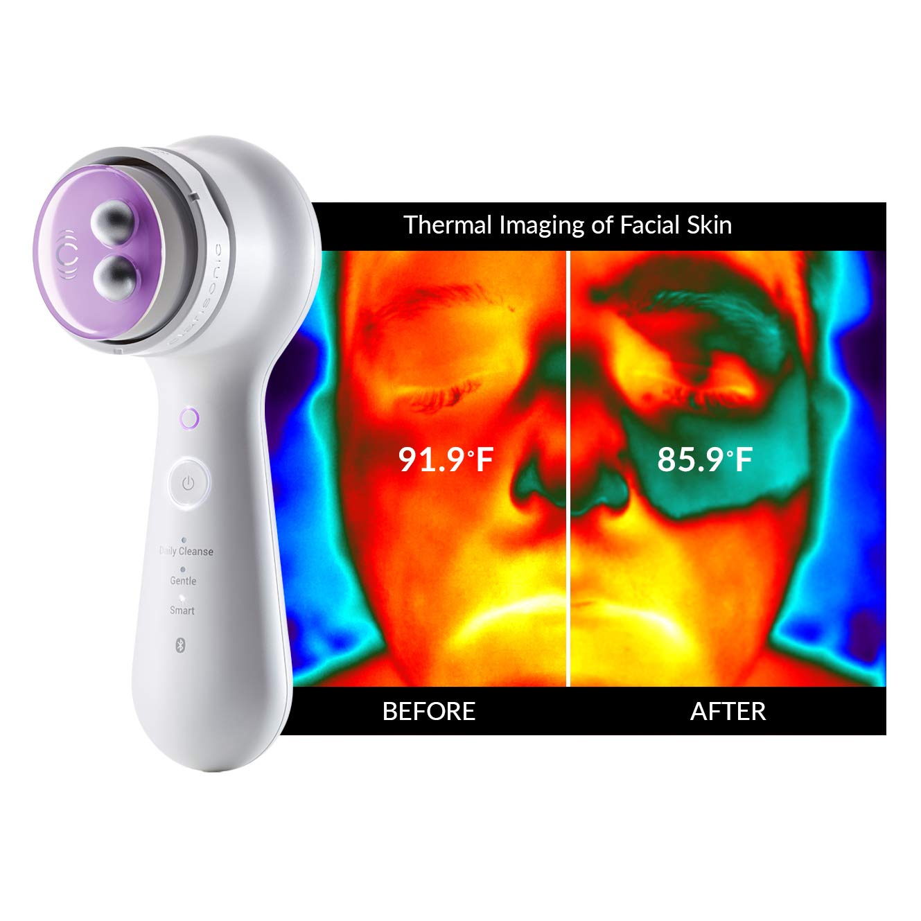 Clarisonic New Mia Smart Skincare set, White